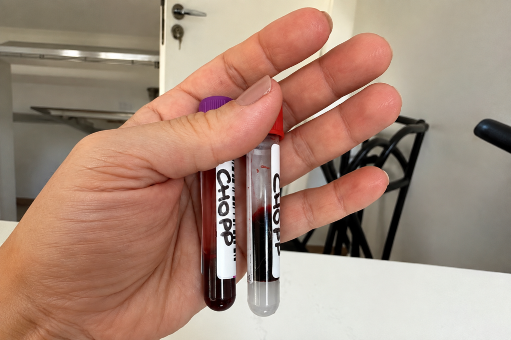 Coleta de sangue para exames pré operatórios do Chopp, um Bulldogue Campeiro de 5 anos - Artigo de Blog da Bicholândia Creche, Hotel e Veterinária na Vila Carrão